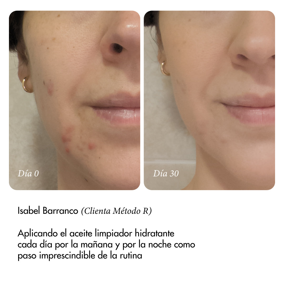 Aceite limpiador hidratante