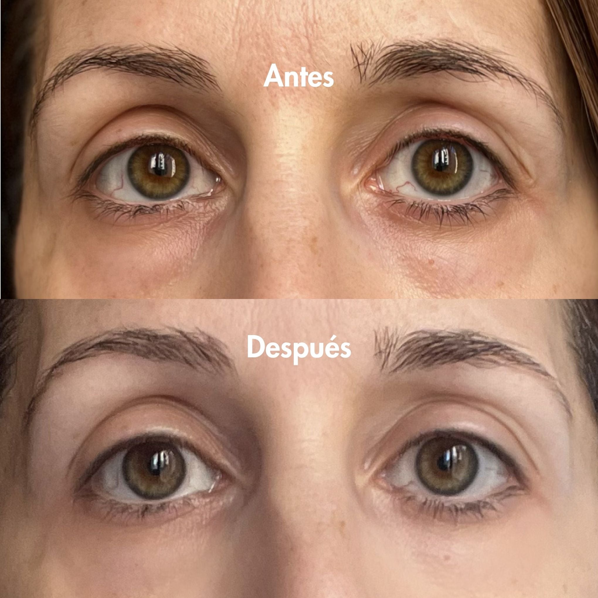 Multivitamin Eye Contour 